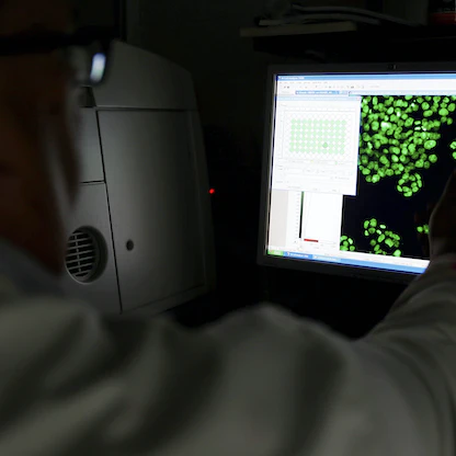 داء باجيت.. سرطان ثدي نادر يصيب السيدات بعد الـ50