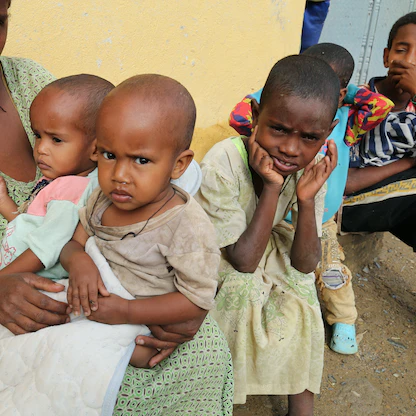 وسط تجدد المعارك.. سوء التغذية الحاد يهدد أطفال تيجراي