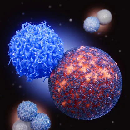 تقنية جديدة تحقق فعالية في علاج سرطان البروستاتا المبكر