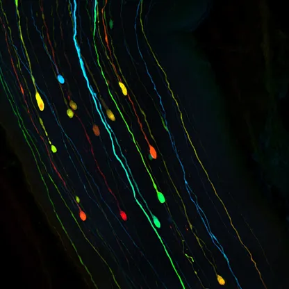 باحثون يتوصلون لأسباب تعافي الجهاز البصري بعد إصابات الدماغ