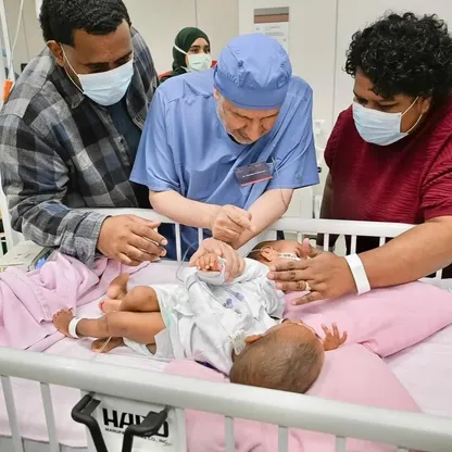 السعودية.. فريق جراحي يبدأ العملية 74 لفصل توأمتين ملتصقتين من فيجي
