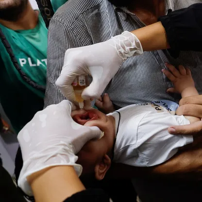 الحرب والمجاعة تزيدان التشوهات الخلقية والولادات المبكرة في غزة