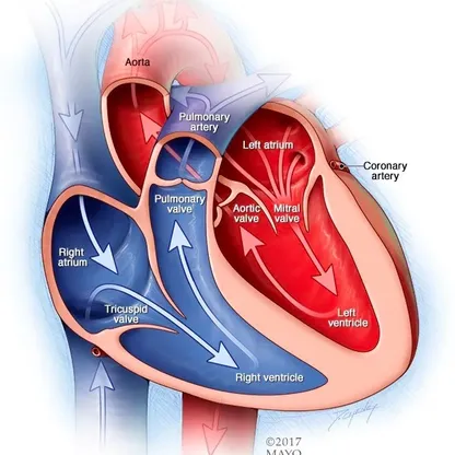 فتح الشرايين المسدودة يقلل من خطر الوفاة بسبب أمراض القلب
