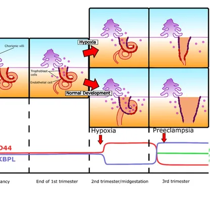 اكتشاف "مؤشرات حيوية" تساعد في علاج اضطراب الحمل المدمر