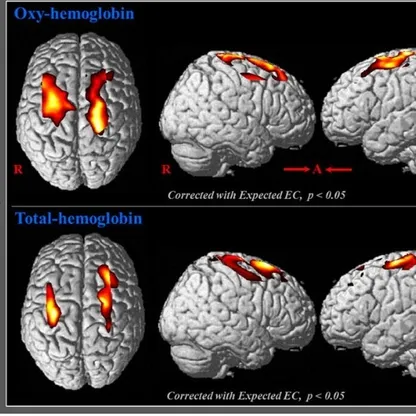 اكتشاف طبي يبشر بعلاج أمراض الشيخوخة والاضطرابات العصبية