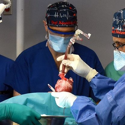 نهج مبتكر في علاج سرطان الرئة بالإشعاع يقلل خطر إصابة القلب