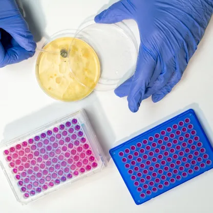 اكتشاف آلية جديدة وراء مقاومة البكتيريا للمضادات الحيوية