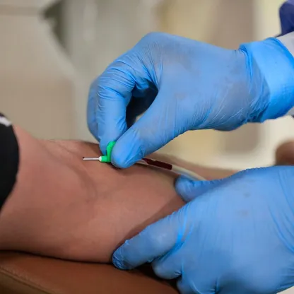 باحثون يطورون نهجاً جديداً لمواجهة الأورام المقاومة للعلاج المناعي