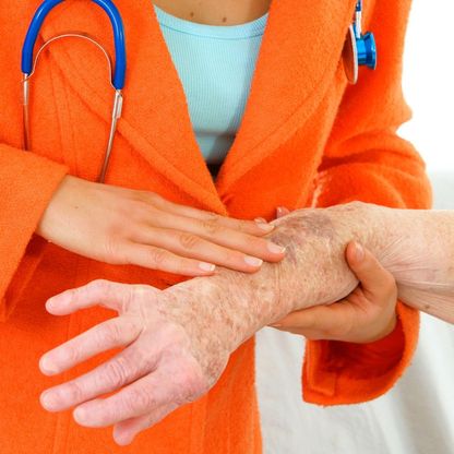 دراسة تكشف: خلايا "الزومبي" قد تساعد في علاج السرطان