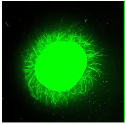 "الجزيئات الراقصة".. علاج تجريبي جديد لإصابات الحبل الشوكي