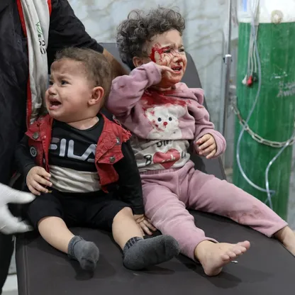 "اليونيسيف": 9 آلاف طفل دون 5 سنوات في غزة يعانون من سوء تغذية حاد