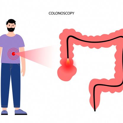 سلائل القولون.. الأعراض والأسباب والعلاج