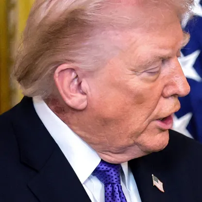 "طفح جلدي" على رقبة ترمب.. البيت الأبيض يوضح السبب