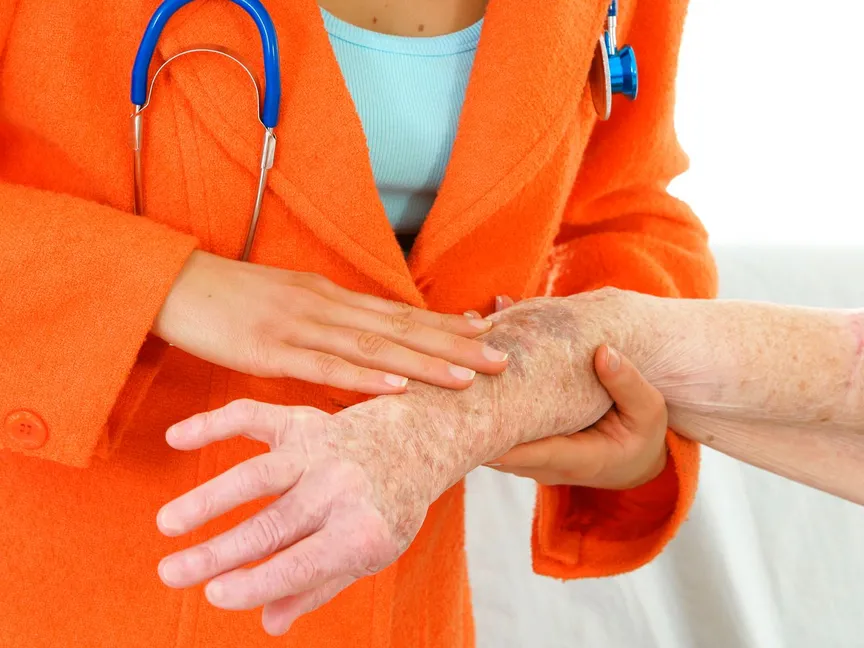 الإصابة بالكدمات أمر شائع ويزداد مع تقدم العمر - Getty Images