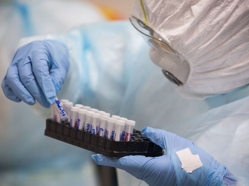 محاولة جديدة.. علماء يخلقون جسماً مضاداً للقضاء على كورونا 