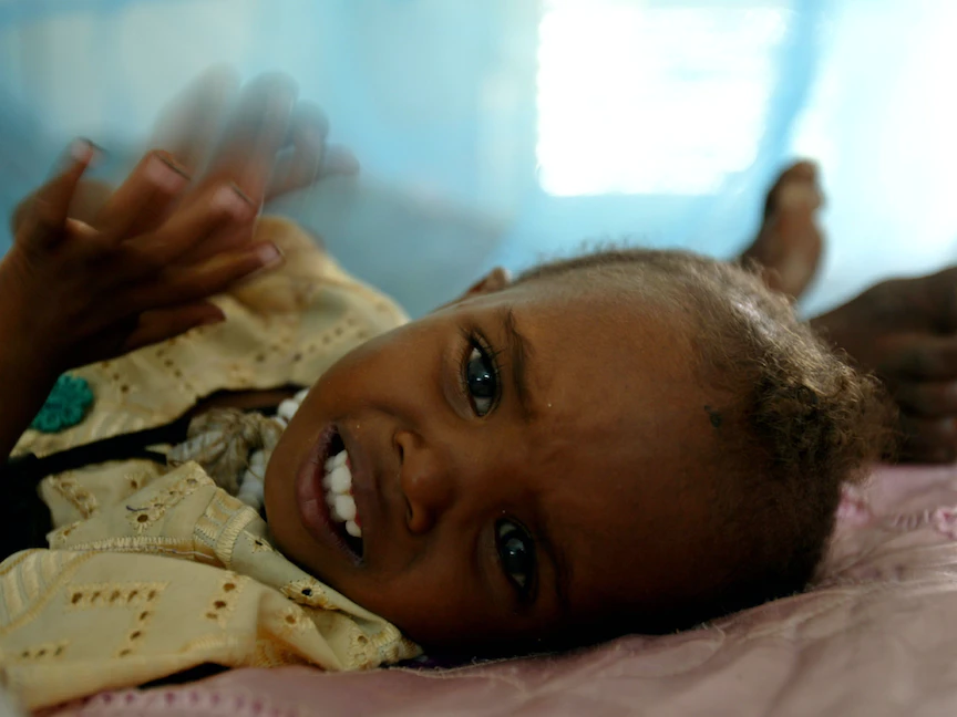 تشاد.. أطفال يقاومون المجاعة من أجل البقاء