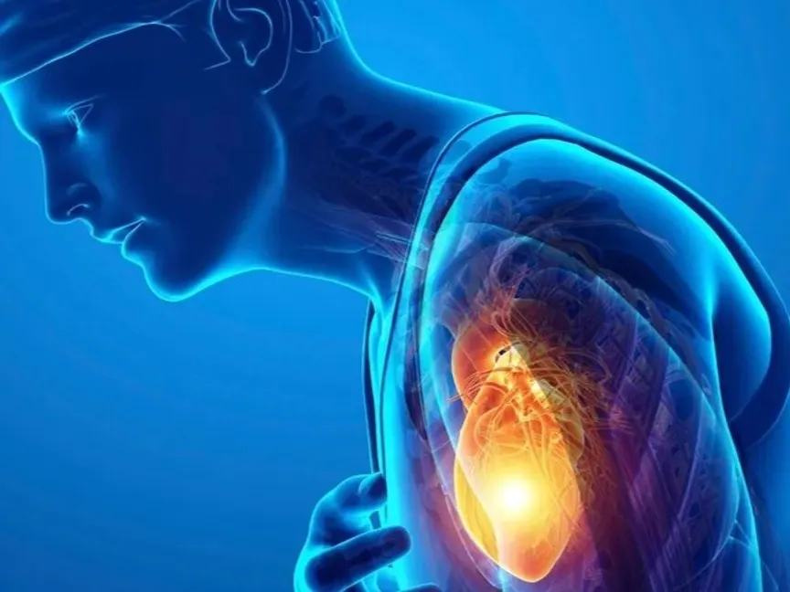 صورة تعبيرية عن الإصابة بنوبة قلبية - AFP