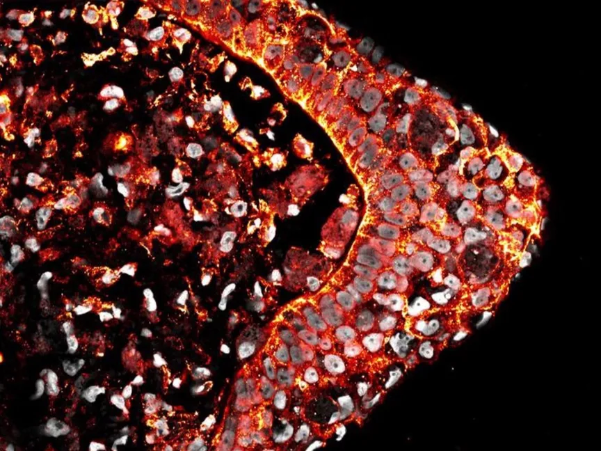 مقطع عرضي مجهري لطرف شرغوف في طور التجدد وتظهر الأغشية باللونين الأحمر والأصفر، بينما تبدو الأنوية باللون الرمادي - https://www.linkedin.com/in/georgios-tsissios-41501ba1/