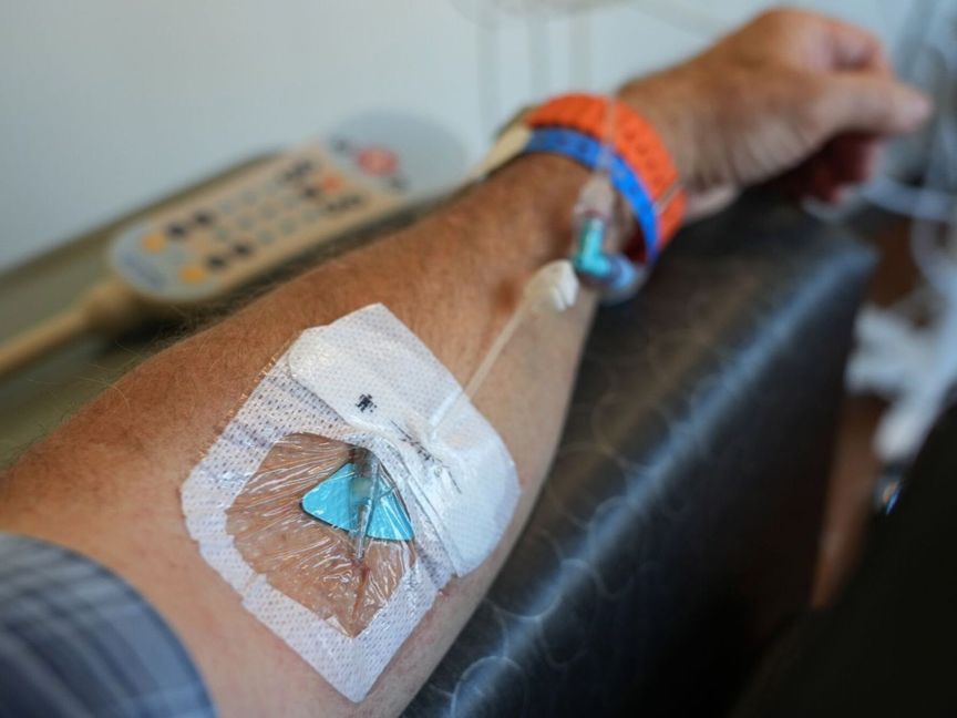 دراسة تكشف عن تقنيات تصوير متقدمة قد تحسن علاج سرطان البروستاتا