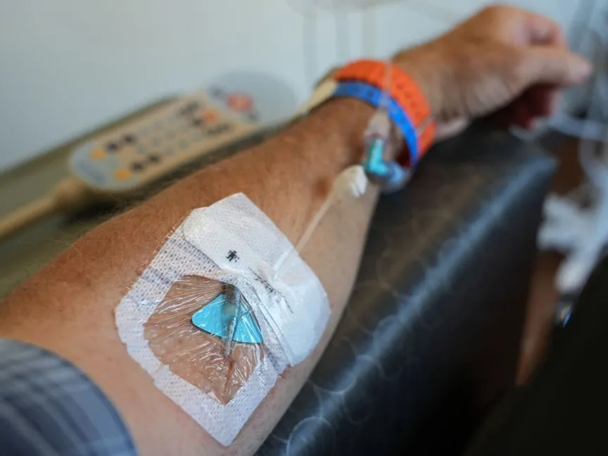 دراسة تكشف عن تقنيات تصوير متقدمة قد تحسن علاج سرطان البروستاتا