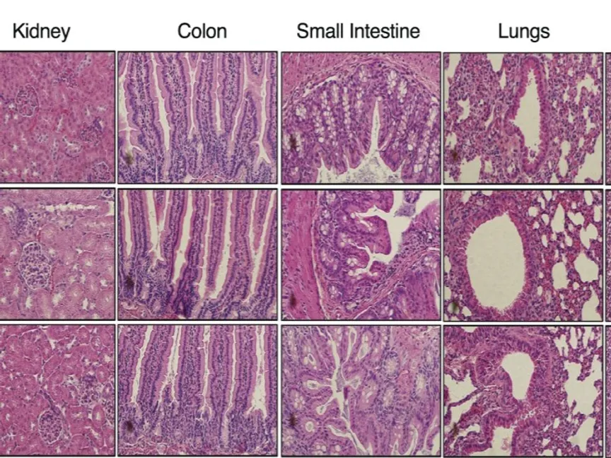 رسم توضيحي لاستجابة فئران التجارب لدواء جديد يقضي على 4 أنواع من السرطان - rupress.org/jem