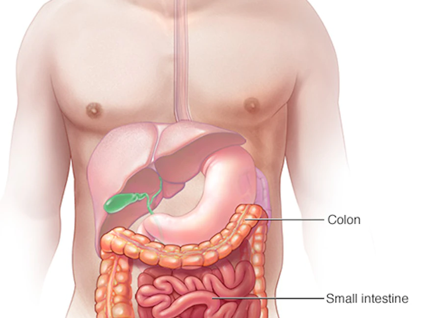 صورة تُظهر الجهاز الهضمي وحالة إقفار الأمعاء. - مايو كلينيك