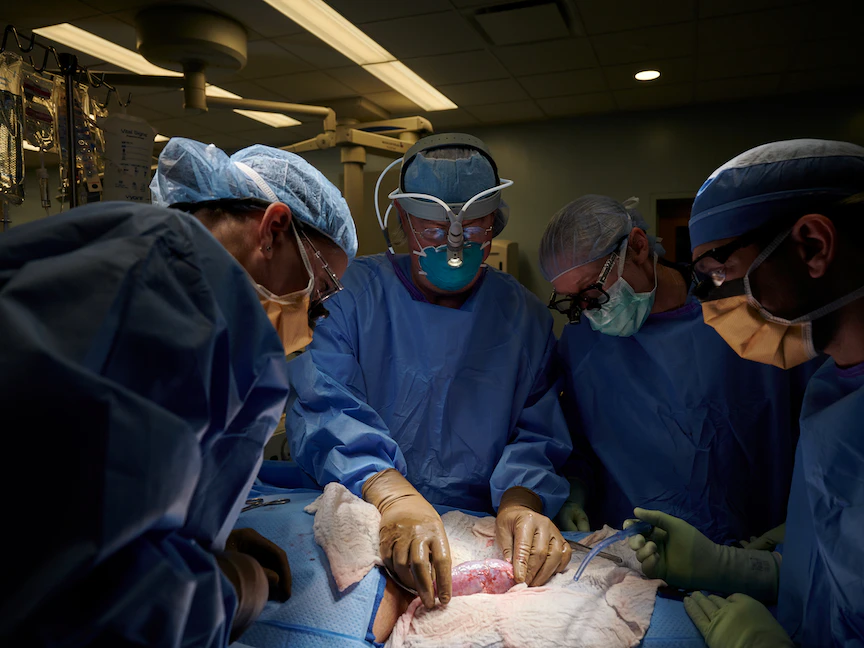 جراحون في جامعة نيويورك لانجون الأميركية يزرعون كلية خنزير في جسم إنسان - 20 أكتوبر 2021 - via REUTERS