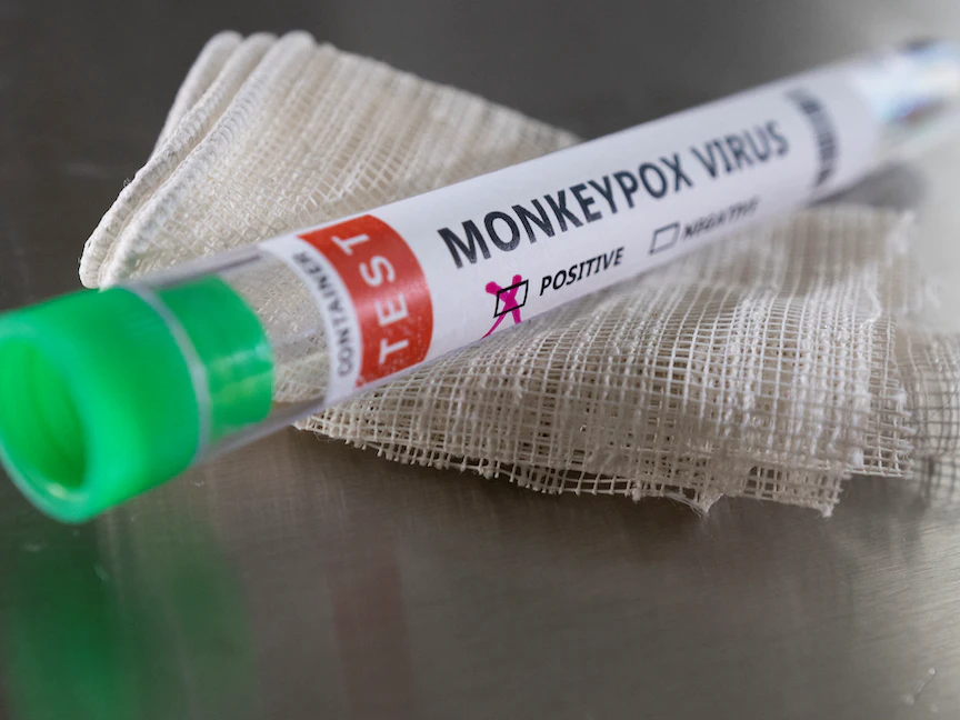 جدري القرود.. 14 إصابة بالبرتغال والفيروس يصل اسكتلندا والدنمارك