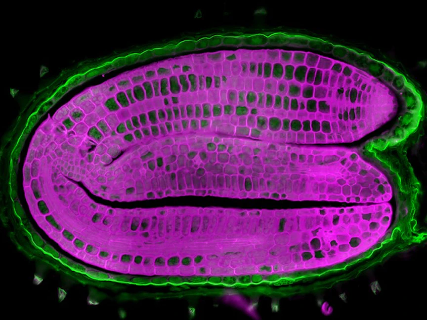 فريق علمي سويسري يكتشف مقياس حرارة داخل بذور النباتات يمكن أن يؤخر أو يمنع الإنبات - ..