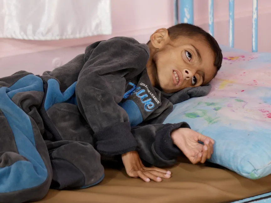 طفل يعاني من سوء التغذية في مستشفى ناصر الطبي جنوب قطاع غزة. 30 أبريل 2025 - Reuters