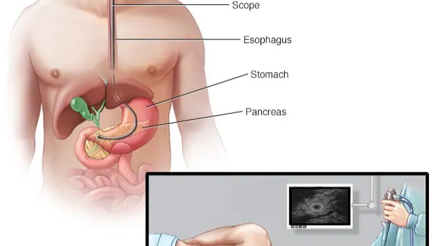 دراسة تكشف عن دور “خفي” للأعصاب في تطور مرض سرطان البنكرياس
