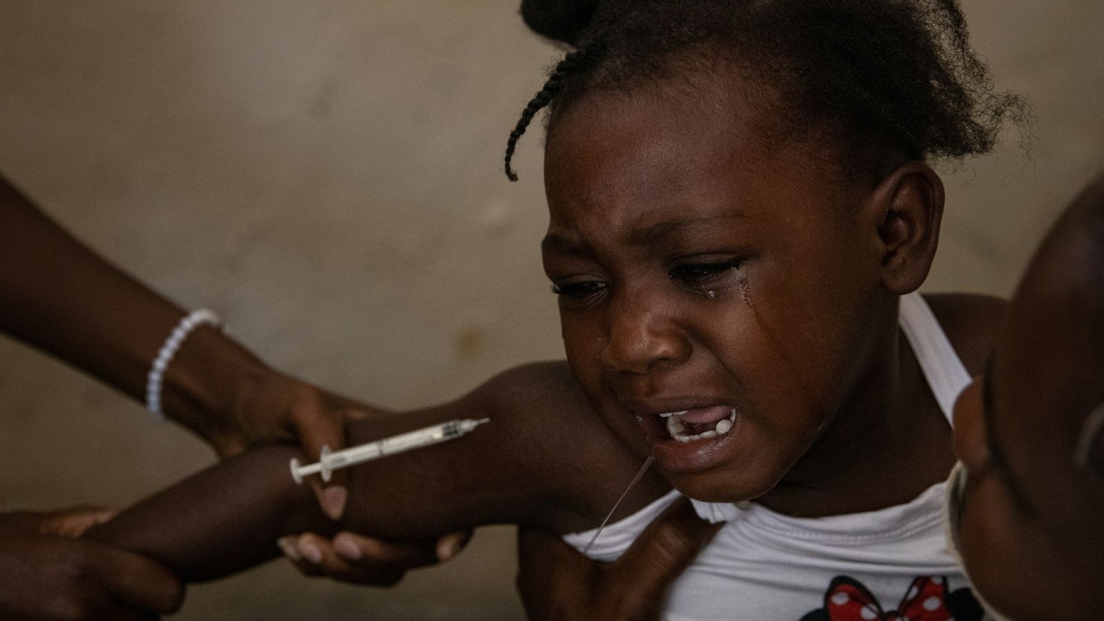 تراجع الإصابات بالحصبة في أوروبا وآسيا الوسطى 75% في 2025