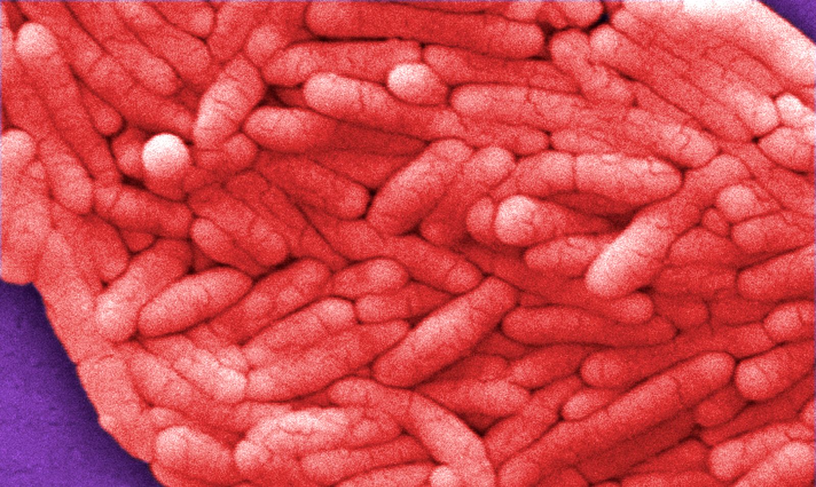 صورة بالمجهر الإلكتروني لبكتيريا السالمونيلا- 7 أغسطس 2009 - REUTERS