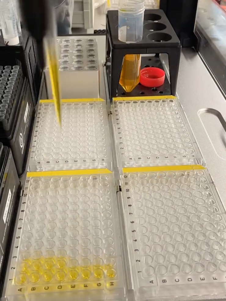 منصة روبوتية تسرع اكتشاف أدوية لمواجهة مقاومة البكتيريا للمضادات الحيوية 