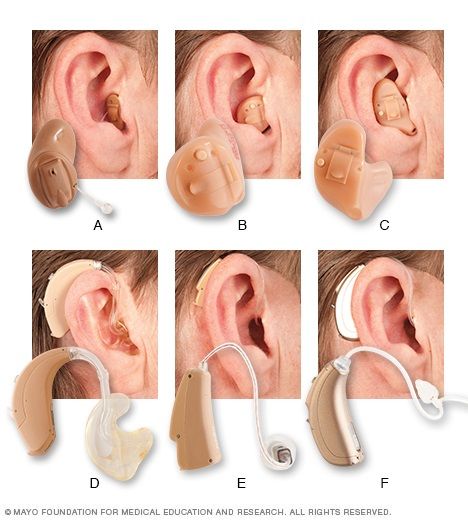 أساليب المساعدة على السمع - mayoclinic