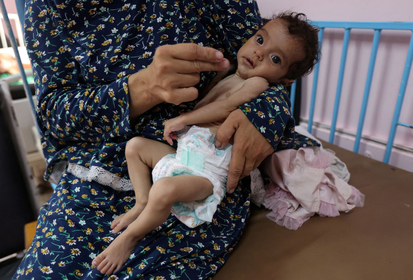 امرأة فلسطينية تحمل ابنتها (5 أشهر) والتي تعاني من سوء التغذية في مستشفى ناصر بجنوب قطاع غزة. 24 يوليو 2025