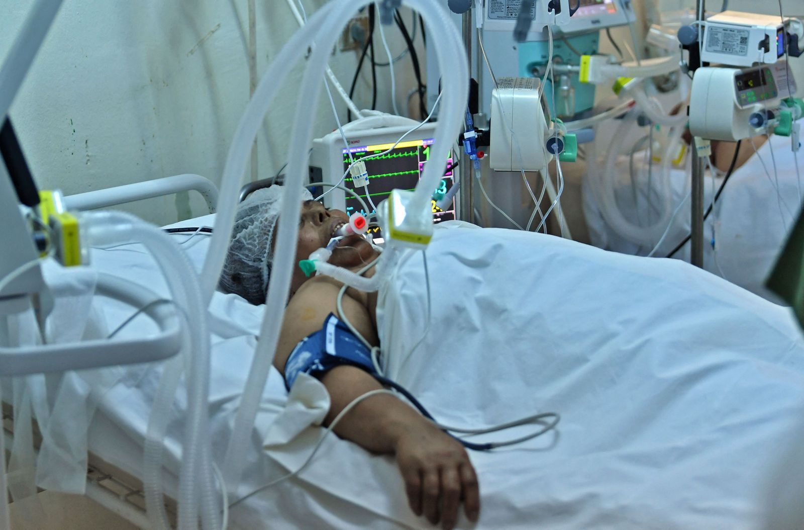 A Tunisian patient infected with COVID-19 is pictured at the intensive care unit of the Aghlabide hospital in the east-central city of Kairouan on July 4, 2021. - Tunisia placed the capital Tunis and the northern town of Bizerte under a partial lockdown from until July 14 in a bid to rein in record daily coronavirus cases and deaths. (Photo by FETHI BELAID / AFP) - AFP