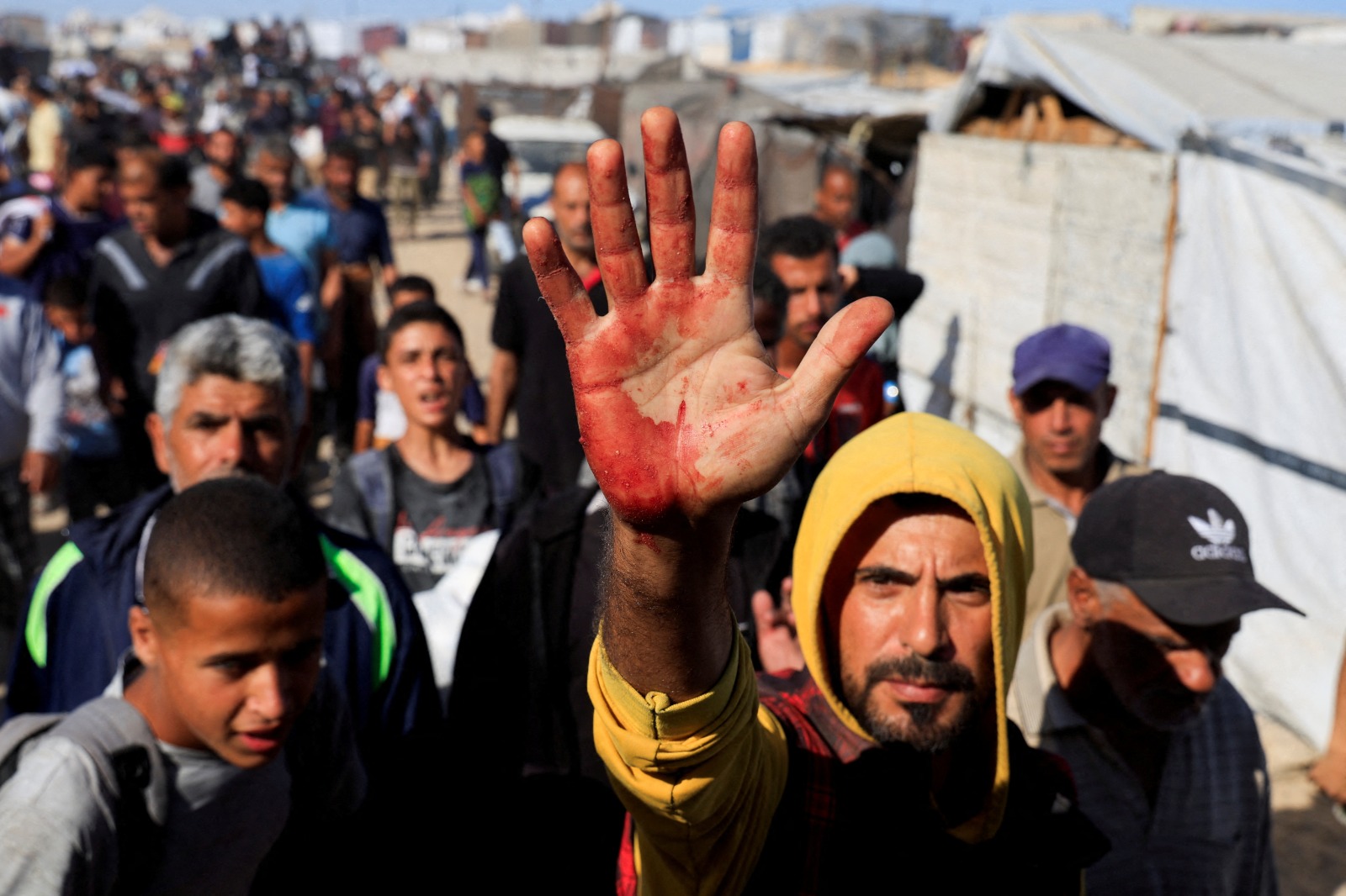 فلسطيني على يده بقع دماء بعد أن حمل مصابين كانوا يسعون للحصول على مساعدات من (مؤسسة غزة الإنسانية) المدعومة من الولايات المتحدة في خان يونس بجنوب قطاع غزة. 29 مايو 2025