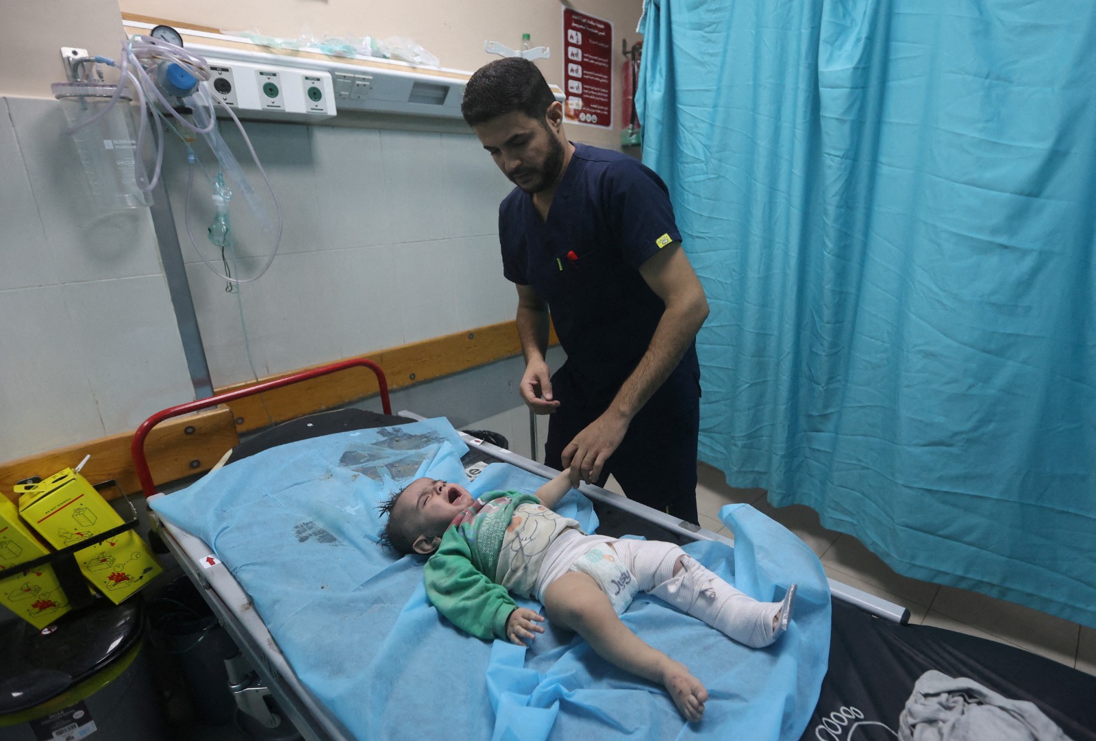 طفل فلسطيني أصيب في غارات إسرائيلية يرقد على سرير أثناء تلقيه الرعاية الطبية في مستشفى في خان يونس بجنوب قطاع غزة. 16 أكتوبر 2023