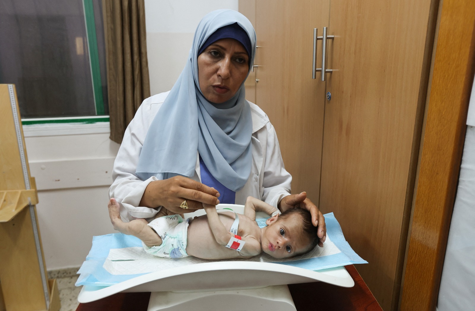 ممرضة تفحص طفلاً يعاني من سوء التغذية في مستشفى ناصر بخان يونس جنوبي قطاع غزة. 25 يوليو 2025