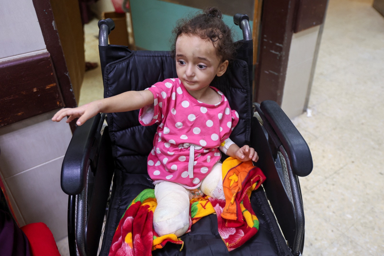 الفتاة الفلسطينية حنان الدقي التي فقدت ساقيها في غارة إسرائيلية تجلس على كرسي متحرك في مستشفى بدير البلح، وسط قطاع غزة. 16 سبتمبر 2024