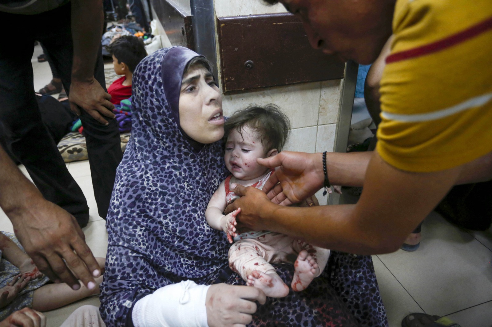 DEIR AL BALAH, GAZA - JUNE 08: Injured Palestinians, including women and children, are brought to Al Aqsa Martyrs Hospital after the Israeli attacks on the camps in central Gaza, in Deir al Balah, Gaza on June 08, 2024. At least 210 died and 400 got injured in the attacks. Ashraf Amra / Anadolu (Photo by ashraf amra / ANADOLU / Anadolu via AFP)