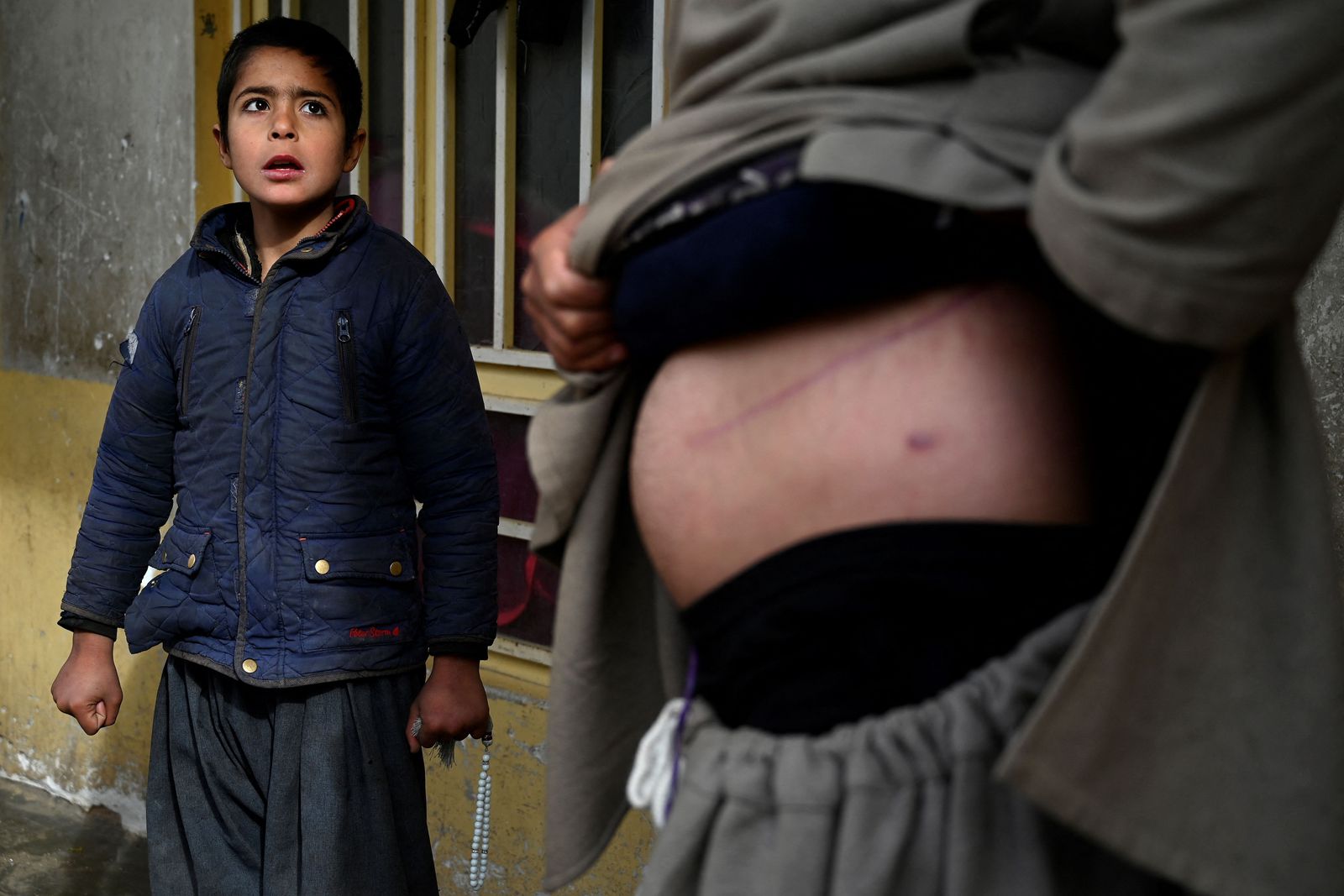 In this photo taken on February 4, 2022, Nooruddin, who sold his kidney to raise money for his family, shows the scars from the operation next to his son Javid at their house in the Khwaja Koza Gar area in Herat. - Jobless, debt ridden, and struggling to feed his children, Nooruddin felt he had no choice but to sell a kidney -- one of a growing number of Afghans willing to sacrifice an organ to save their families. (Photo by Wakil KOHSAR / AFP) / To go with AFP story Afghanistan-Economy-Health-Organs, FEATURE by Rouba EL HUSSEINI - AFP