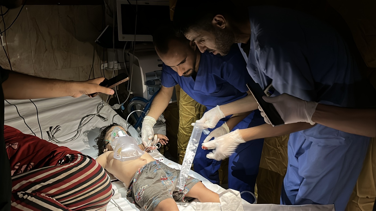 أطباء يحاولون إسعاف طفل فلسطيني أصيب في غارة إسرائيلية، باستخدام أضواء الهاتف بعد انقطاع الكهرباء عن مستشفى الأقصى في دير البلح. غزة. 7 يوليو 2025