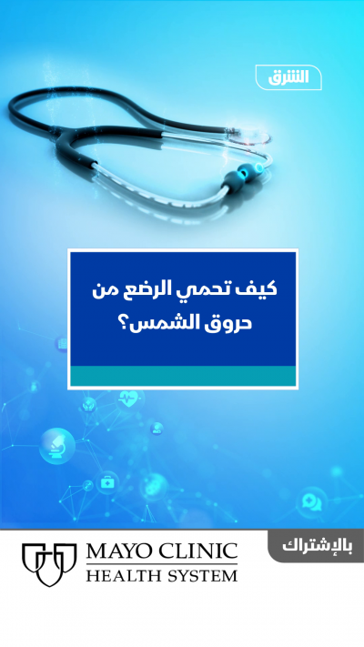 مايوكلينيك.. كيف تحمي الرضع من حروق الشمس؟