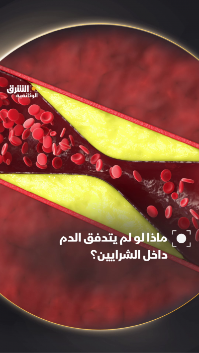 ماذا يحدث لو توقف تدفق الدم داخل الشرايين؟ وكيف سيؤثر ذلك على وظائف الجسم وأعضائه المختلفة، خاصة مع تأثيرات نقص الأوكسجين والمغذيات التي يحتاجها الجسم للبقاء على قيد الحياة؟ تابعوا وثائقي "حياة أكثر شباباً.. اللياقة البدنية" على #الشرقالوثائقية عبر مختلف 