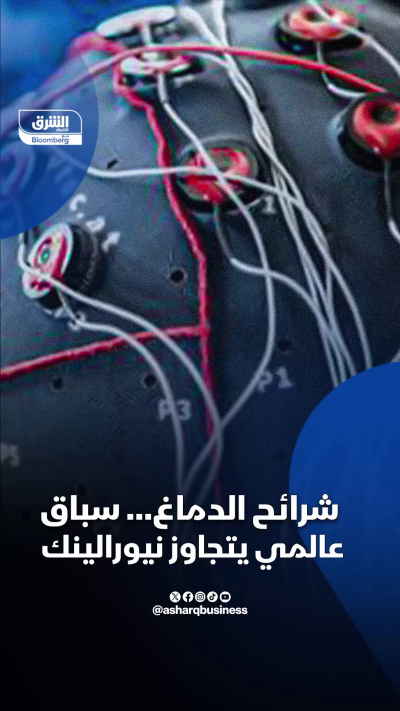 شرائح الدماغ.. سباق بين أميركا والصين